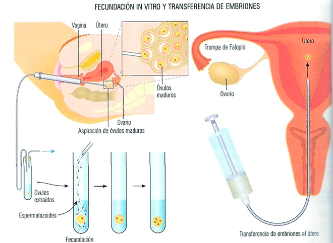 fecundacion-in-vitro-proceso